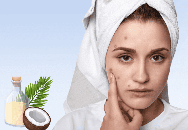 Benefits of applying Coconut Oil on the Face