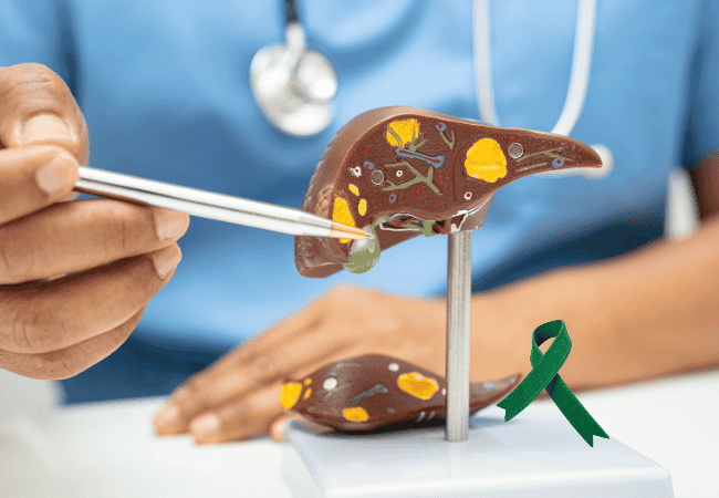 Diet For Liver Cancer Patients